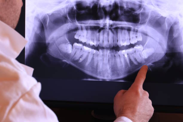 Best Weekend Emergency Dentist in Morrisville, VT